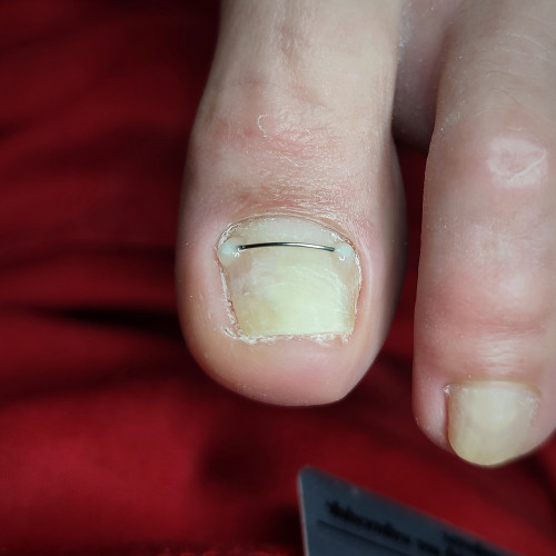 Beautiful Nails Незалежності 148а манікюр педикюр подолог. 0935893133 фото 3