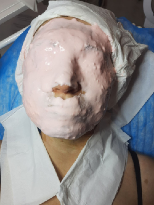 Косметолог метро Лівобережна (чистки,пілінг,мікронідлінг,карбоксі) фото 7