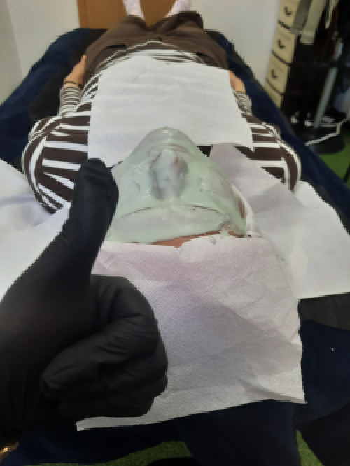 Косметолог метро Лівобережна (чистки,пілінг,мікронідлінг,карбоксі) фото 8